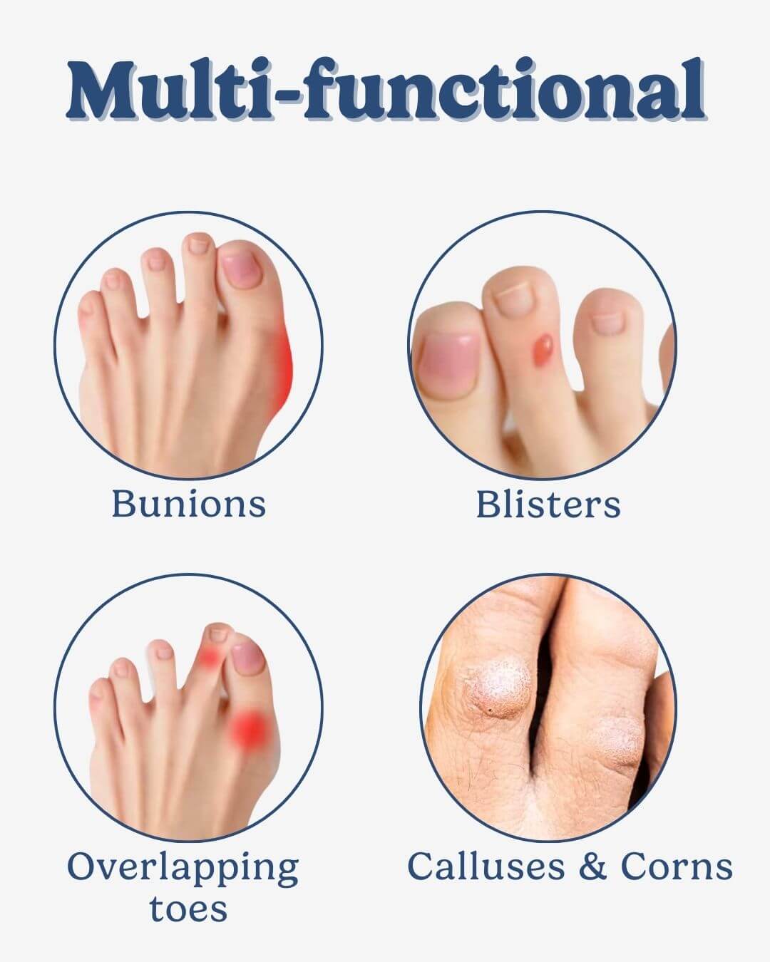 Toe Separator Bandage