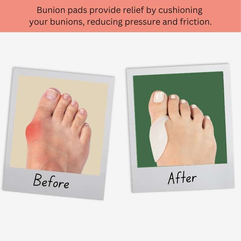 Bunion pads sale for high heels